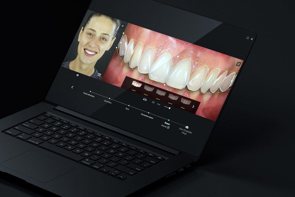 Smile Simulation - DDS