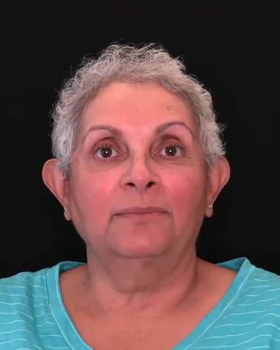 Marlene, TMD patient at DDS with a Smile